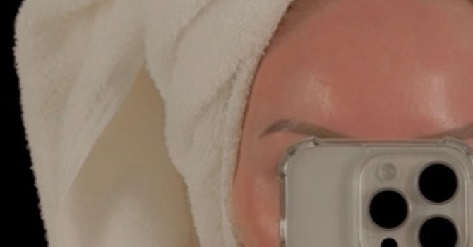 Finding Your Skin’s Perfect Balance image